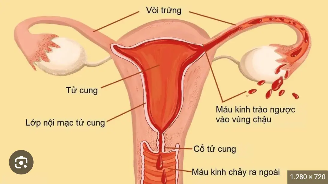 Bong Tróc Niêm Mạc Tử Cung Sau Phá Thai Có Nguy Hiểm ? Thuốc Phá Thai Tại Việt Nam .