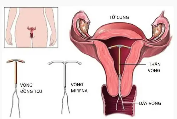 Tiêm thuốc tránh thai có an toàn không? Bao lâu thì quan hệ được? Thuốc Phá Thai Tại Malaysia .