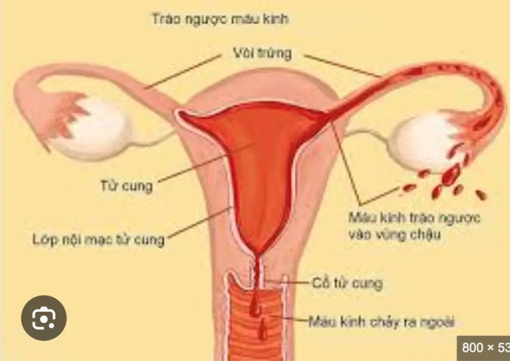 Một số phương pháp giúp bạn mang thai khi mắc đa nang buồng trứng . Thuốc Phá Thai Tại Singapore .